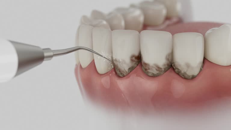 Trusted Tooth Extraction service in Brunswick, NC - Dentist Open Now
